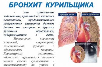 Бронхит курильщика является хронической болезнью
