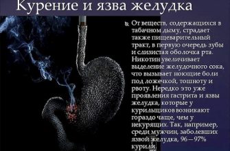 Курение и язва желудка несовместимы и опасны
